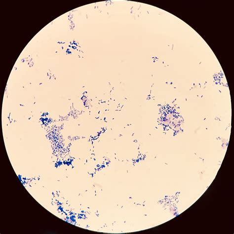e coli acid fast stain|acid fast staining technique.